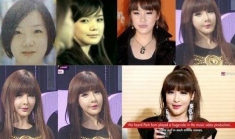 Park Bom 2NE1 dan dagu-dagunya 