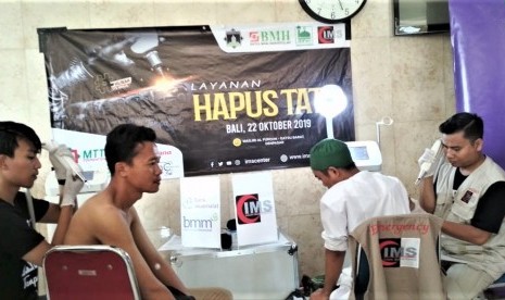 Pelaksanaan kegiatan hapus tato.