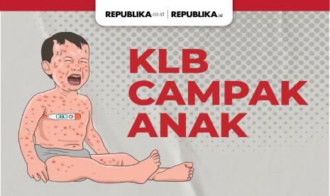 Mungkinkah seseorang terkenal campak lebih dari sekali? (ilustrsi)