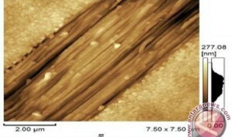 Perekatan tulang yang rusak dengan kolagen ikan. (Tokyo Institute of Technology)