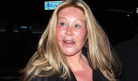 Perempuan yang gemar operasi plastik, Jocelyn Wildenstein