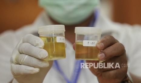 Petugas Badan Narkotika Nasional (BNN) menunjukkan sampel tes urine anggota DPR dari Fraksi PKS di Kompleks Parlemen, Senayan, Jakarta, Senin (29/2).  (Republika/Rakhmawaty La'lang)