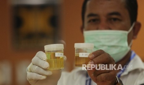 Petugas Badan Narkotika Nasional (BNN) menunjukkan sampel tes urine anggota DPR dari Fraksi PKS di Kompleks Parlemen, Senayan, Jakarta, Senin (29/2).  (Republika/Rakhmawaty La'lang)