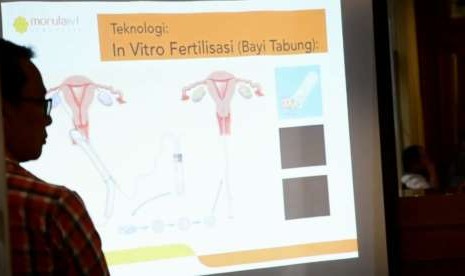 Presentasi proses program bayi tabung (ilustrasi)