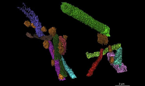 Rekonstruksi 3 dimensi (3D) dari fosil bakteri Gunflintia dimakan oleh bakteri heterotrophic (berwarna oranye).