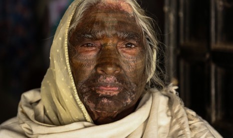 Samund Bai (75 tahun), warga desa Baday Sipat, India yang berkasta Dalit dengan tato Dewa Ram di wajahnya.