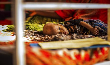 Seorang bayi dengan gizi buruk menerima perawatan di pusat stabilisasi yang didukung UNICEF di Rumah Sakit Gode di Zona Shabelle, wilayah Somalia, Ethiopia, Selasa, 12 April 2022. Kepala Program Pangan Dunia PBB David Beasley mengatakan, lonjakan harga makanan, bahan bakar, dan pupuk yang dipicu oleh perang di Ukraina mengancam akan mendorong negara-negara di seluruh dunia ke dalam kelaparan.