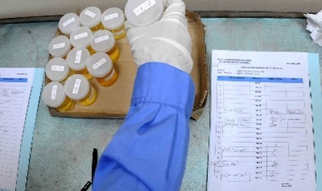 Tes urine untuk mengidentifikasi penggunaan narkoba.