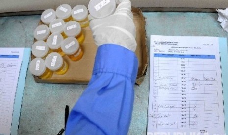 Tes urine untuk mengidentifikasi suatu penyakit