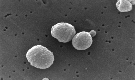 The bacterium Streptococcus pneumoniae, a common cause of pneumonia, imaged by an electron microscope (file)