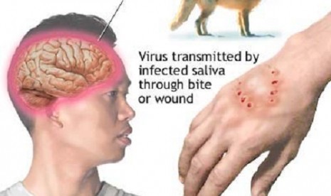 Virus rabies bisa sampai ke otak manusia dan berakibat fatal (ilustrasi)