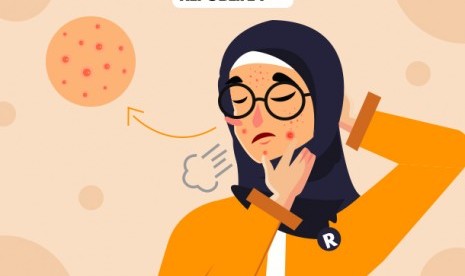 Penyebab kulit berjerawat meski sudah memakai skincare. (ilustrasi)