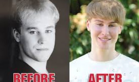 Toby Sheldon yang kini mirip dengan Justin Bieber