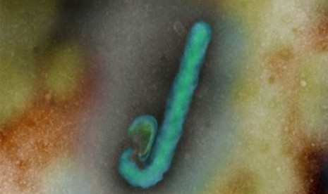  Ebola virus (illustration)