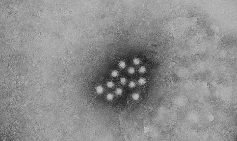 Virus hepatitis A