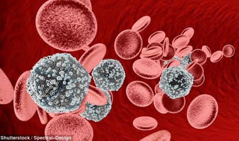 Varian HIV yang sangat mematikan terdeteksi di Belanda. Ilustrasi