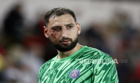 Wajah kiper Paris Saint Germain (PSG) Gianluigi Donnarumma terluka setelah terkena pul sepatu pemain AS Monaco dalam pertandingan Liga Prancis..