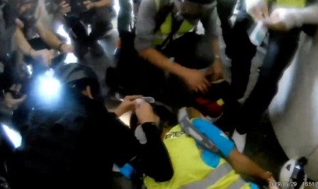 Wartawan Indonesia Veby Mega Indah menerima tindakan medis darurat ketika matanya ditembak peluru karet polisi Hong Kong, Ahad (29/9).