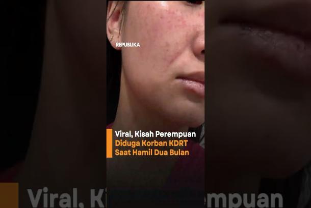 Alami KDRT Sejak Hamil Dua Bulan Katryna Cari Keadilan ke Polisi