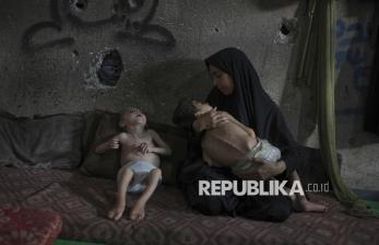Potret Pilu Anak-Anak Gaza yang Menderita Kelaparan Akut