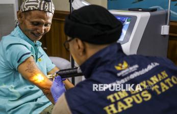 Layanan Hapus Tato, Ikhtiar Menyambut Lembaran Baru