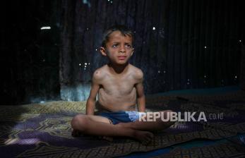 In Picture: Kisah Pilu Anak Gaza, Hidup Dalam Bayang-bayang Kelaparan