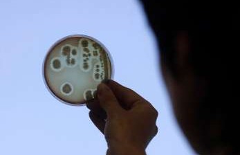 Ilmuwan Temukan Bakteri Raksasa, Bisa Dilihat tanpa Mikroskop 