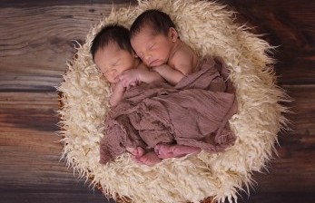 Bayi Kembar Siam Dempet Bokong Asal Tulungagung Jalani Pemisahan Saat Berusia 8-12 Bulan