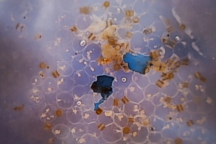 [Ilustrasi] Dua fragmen mikroplastik biru, kemungkinan berasal dari alat tangkap yang dibuang. 