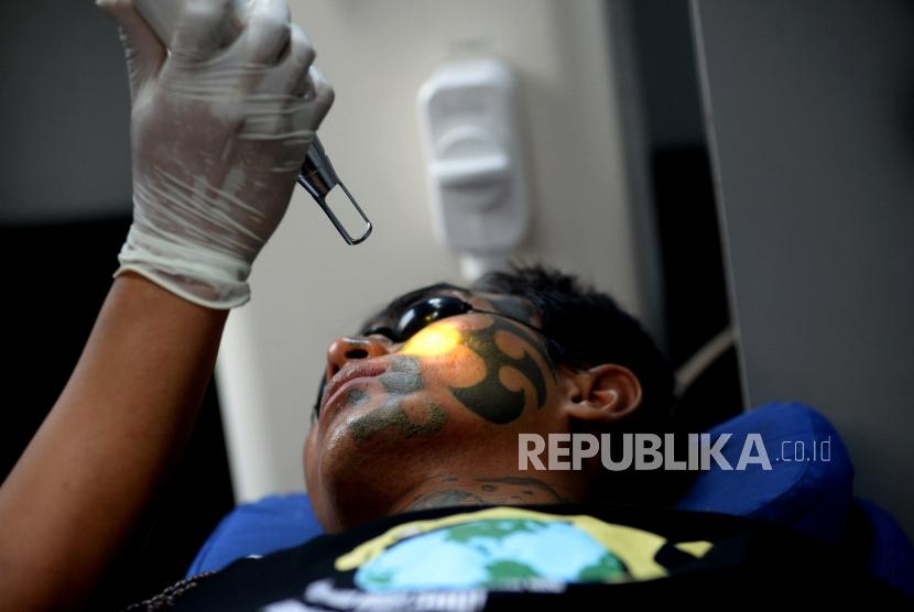 Anak punk melakukan proses penghapusan tato saat memanfaatkan layanan hapus tato gratis di kolong jembatan stasiun tebet, Jakarta, Sabtu (18/5).