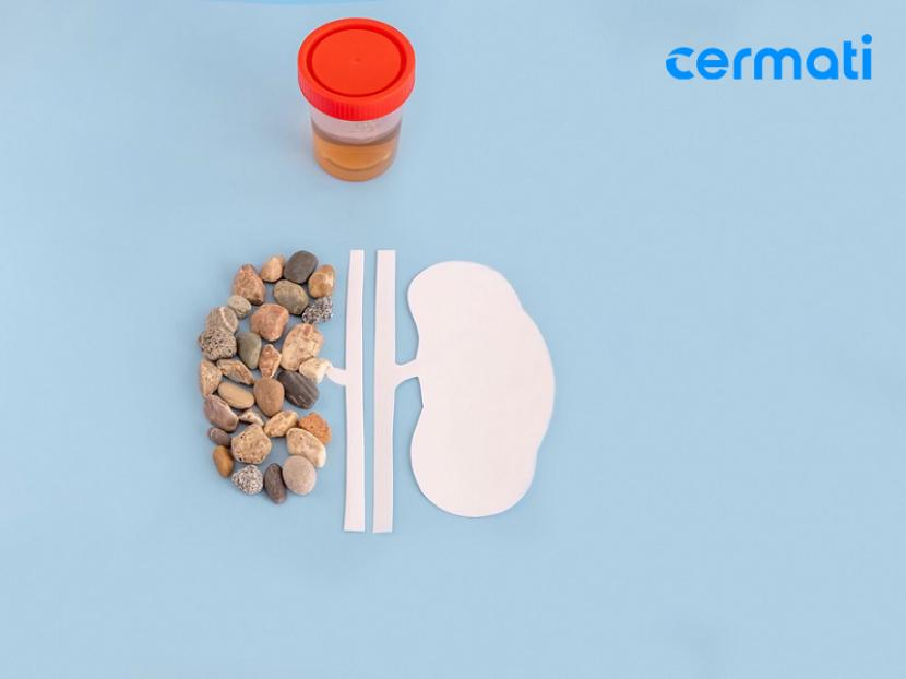 Cermati