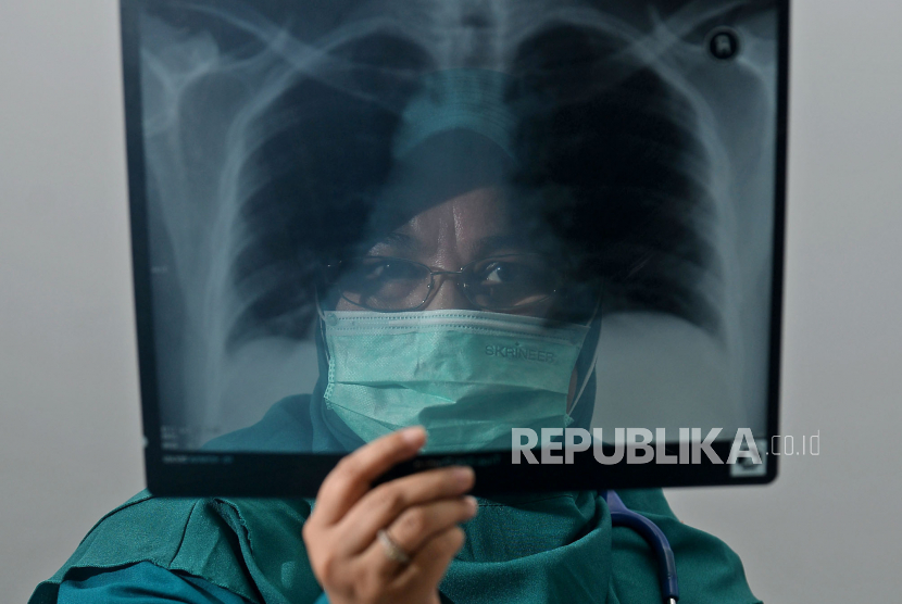 Dokter spesialis paru Erlina Burhan saat sesi foto untuk Tokoh Perubahan Republika 2020 di Jakarta. Menurut dr Erlina, Indonesia perlu meniru langkah tegas Singapura yang memperlakukan penggunaan rokok elektrik (vape) sebagai bentuk penyalahgunaan narkoba. 