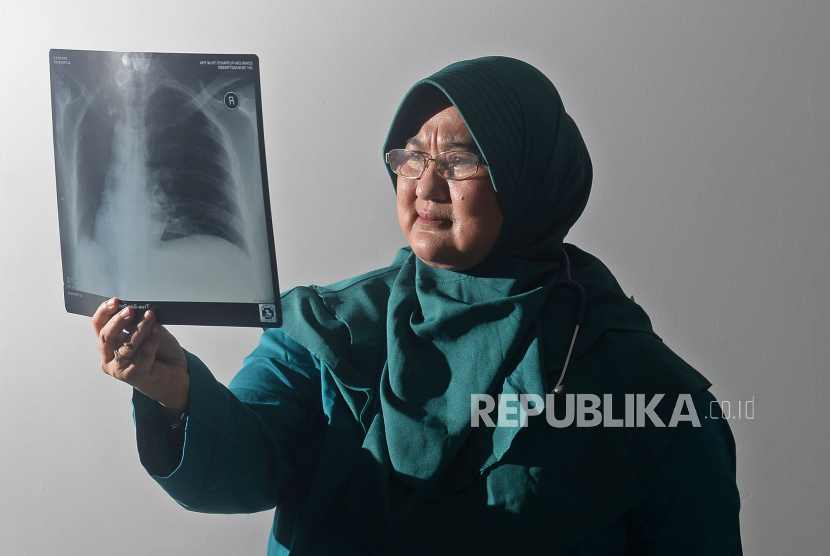 Dokter Spesialis Paru RSUP Persahabatan Jakarta Erlina Burhan.