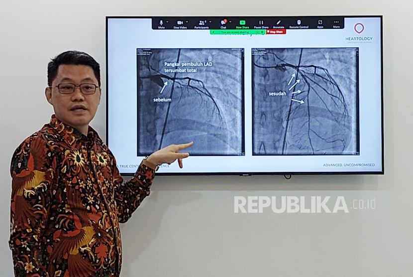 Consultant cardiologist dari Heartology, Dr dr Jajang Sinardja SpJP(K), memberikan penjelasan mengenai Primary PCI untuk menolong pasien serangan jantung. 