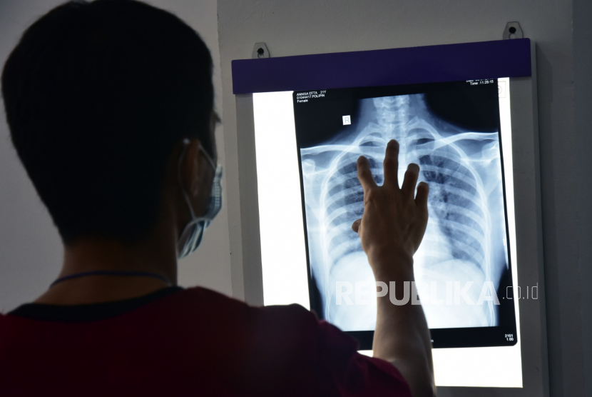 Sejumlah dokter memeriksa hasil rontgen pasien terduga COVID-19 (ilustrasi). Seorang anak berusia sembilan tahun di Kabupaten Bintan, Kepulauan Riau, dinyatakan sembuh dari COVID-19 setelah menjalani perawatan dan karantina di Rumah Sakit Raja Ahmad Thabib (RSUP Kepulauan Riau) sekitar tiga pekan.