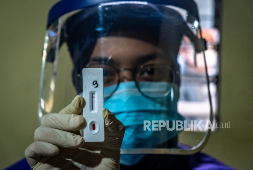 PT Angkasa Pura I (Persero) menyiapkan 500 unit alat rapid diagnostic test (RDT) Covid-19 di Bandara Internasional Yogyakarta, Kulon Progo, Daerah Istimewa Yogyakarta.