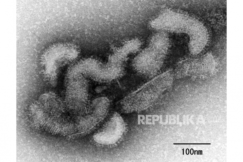 oto selebaran tak bertanggal yang disediakan oleh National Institute of Infectious Diseases (NIID) menunjukkan mikrograf elektron dari virus Oz (diterbitkan 23 Juni 2023).