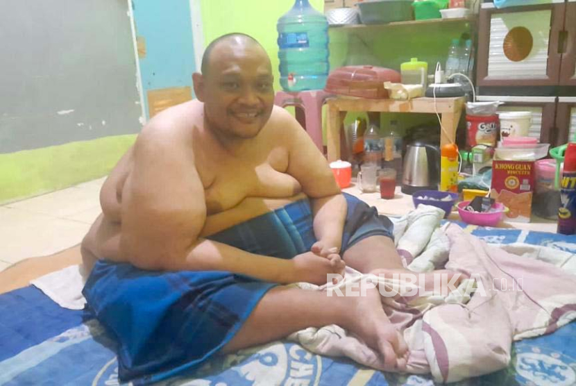 Warga Kota Bogor, Singgih Sugiarto (44 tahun), pengidap obesitas yang kini tinggal di rumah ibunya di Cibinong, Kabupaten Bogor, Selasa (10/10/2023), menanti bantuan untuk berobat.