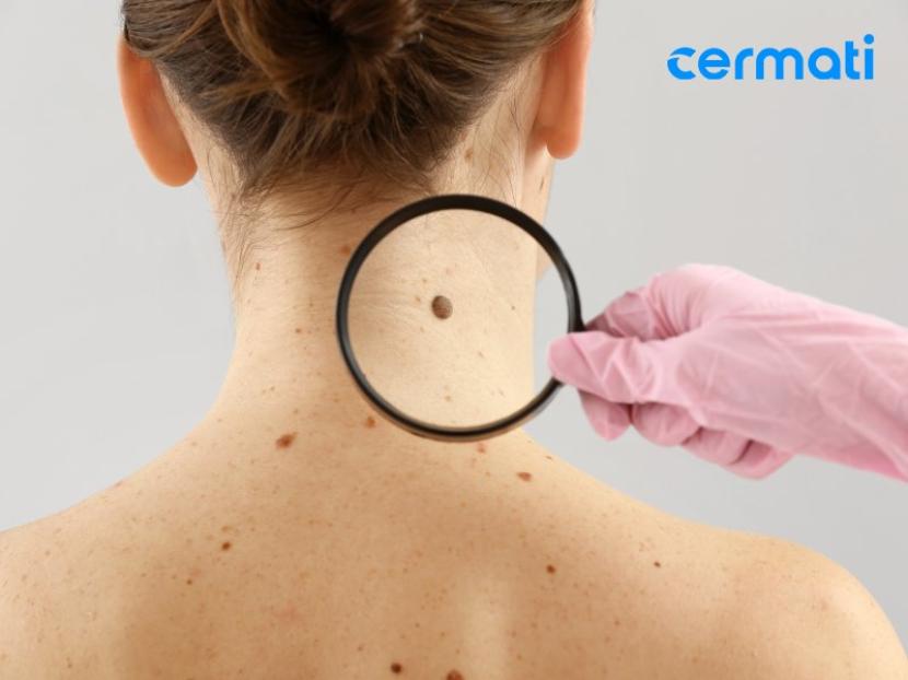Cermati
