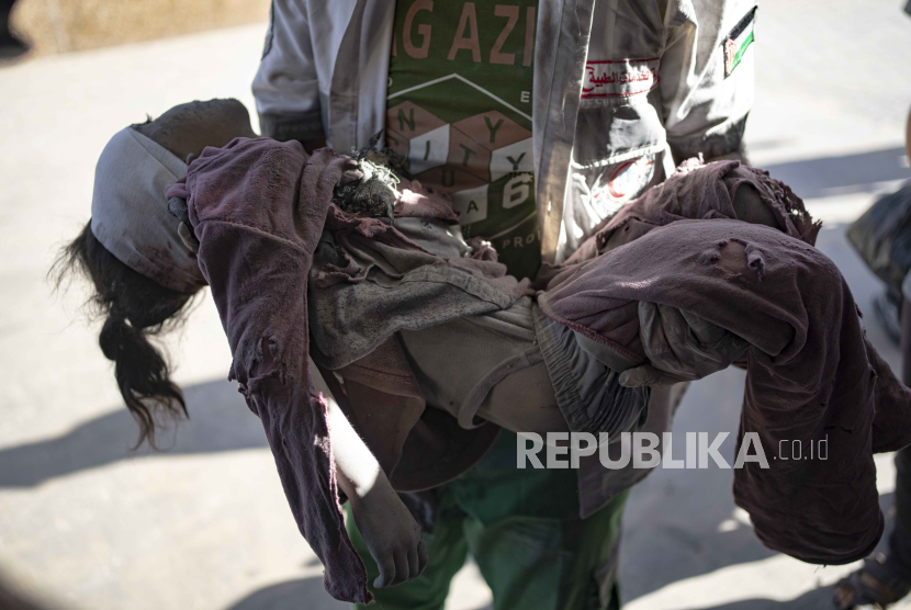 Seorang anak warga Palestina terluka parah dan dibawa ke Rumah Sakit di Khan Younis akibat serangan Bom Israel di Gaza.