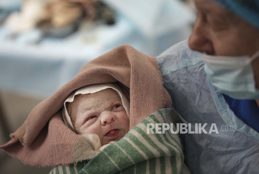 Seorang petugas medis menggendong bayi perempuan yang baru lahir, Alana, yang lahir melalui operasi caesar di sebuah rumah sakit di Mariupol, Ukraina, Jumat, 11 Maret 2022. Operasi caesar bukanlah kegagalan seorang ibu dalam persalinan.