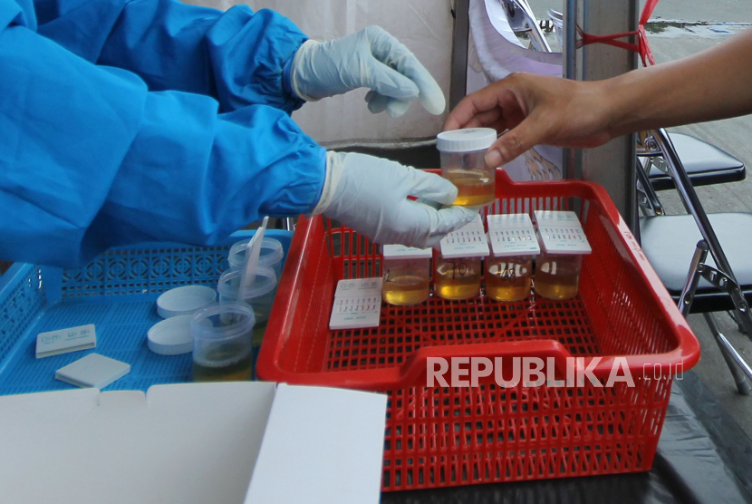 Tes urine untuk untuk para sopir bis yang digelar Satuan Reserse Narkoba (Satresnarkoba) Polrestabes Bandung bekerjasama dengan Badan Narkotika Nasional (BNN)