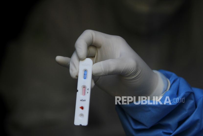 Petugas kesehatan menunjukkan sampel saat diagnostik cepat COVID-19 atau Rapid Test di kawasan Pasar Sentra Antasari, Banjarmasin, Kalimantan Selatan. Sebanyak 18 orang pasien COVID-19 yang dirawat di beberapa rumah sakit di Kalimantan Selatan maupun karantina khusus dinyatakan sembuh setelah hasil pemeriksaan PCR nya menunjukkan negatif.