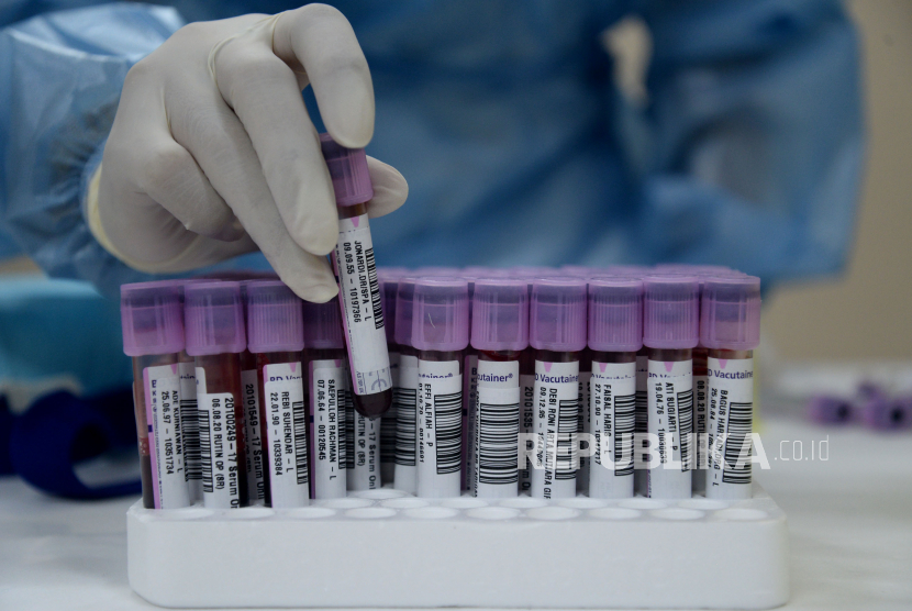 Bogor Terima Bantuan Alat PCR Portabel. Petugas medis menunjukkan sampel darah untuk dites PCR.