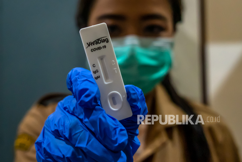 Petugas menunjukkan alat tes cepat (rapid test) COVID-19. Hasil tes cepat (rapid test) pendeteksian virus corona baru terhadap 131 orang yang pernah bersentuhan dengan dua pasien COVID-19 di Provinsi Jambi dinyatakan negatif