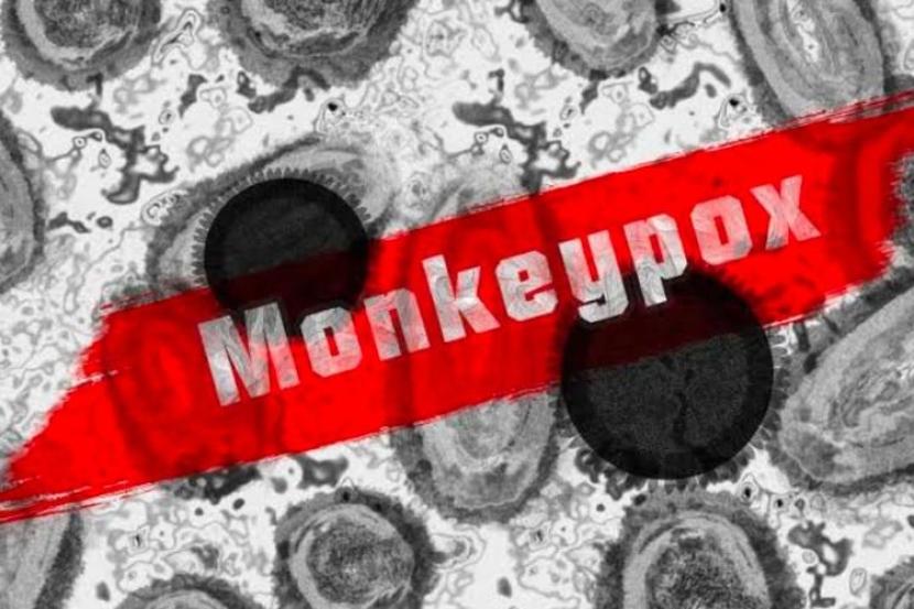 Pandangan Epidemiolog UI, Ini Cara Pencegahan dan Pengobatan Monkeypox