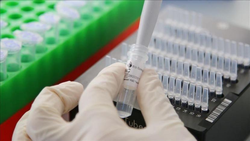 Calon vaksin yang sedang dikembangkan oleh Pfizer dan BioNTech mampu menstimulasi antibodi dan tanggapan sel T - Anadolu Agency
