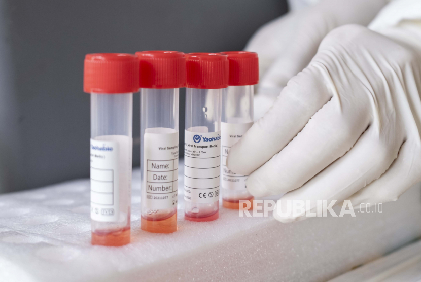 Badan Kesehatan Dunia (WHO) memastikan tes PCR dapat mendeteksi infeksi varian Omicron Covid-19. 