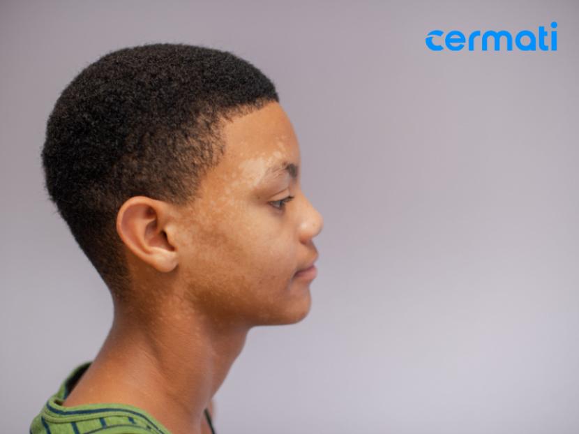 Cermati