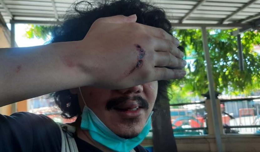 Editor detikcom Jadi Korban Komplotan Penjahat Jalanan di Wonokromo, Surabaya